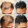 4072f36b-f302-4f95-9232-6eb... - Capital Hair Restoration - ...