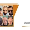 Capital Hair Restoration - Hair Transplant