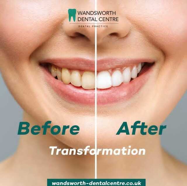 WhatsApp Image 2024-12-22 at 19.58.08 4391594d wandsworth dental Center