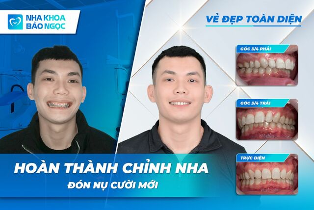 nguyen-minh-duc Picture Box