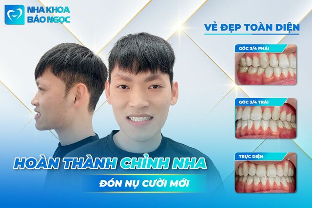 khanh-duy-thao-nieng-rang Picture Box