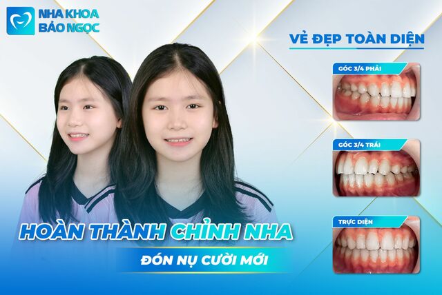 hien-thu-sau-thao-nieng Picture Box