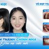 kim-ngan-thao-nieng-rang - Picture Box