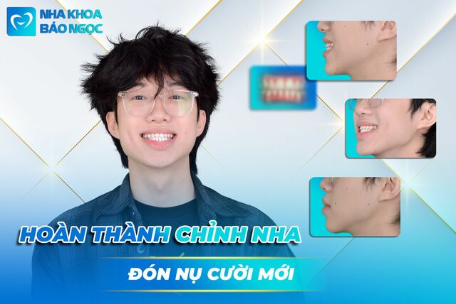 dang-chien-thang (1) Picture Box