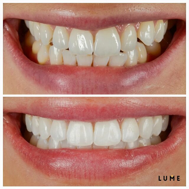 Best dentist in Wilmslow (2) LUME DENTAL