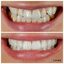 Best dentist in Wilmslow (2) - LUME DENTAL
