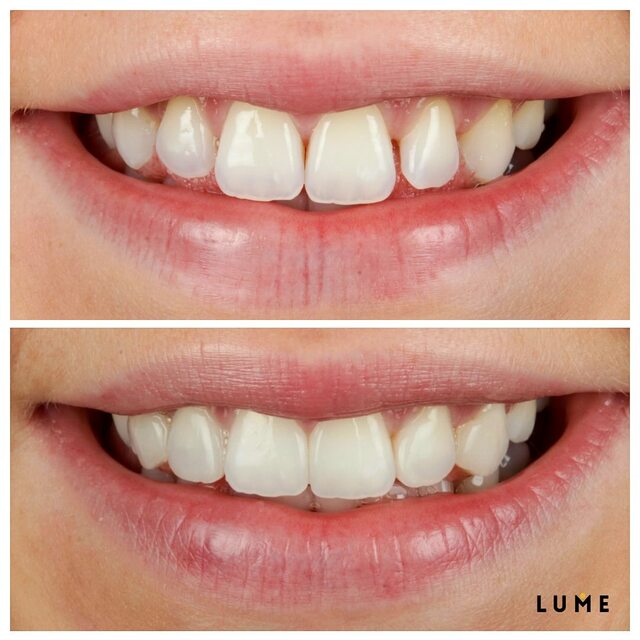 Dental Care Clinic Wilmslow LUME DENTAL
