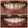 Dentists Wilmslow - LUME DENTAL