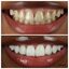 Dentists Wilmslow - LUME DENTAL