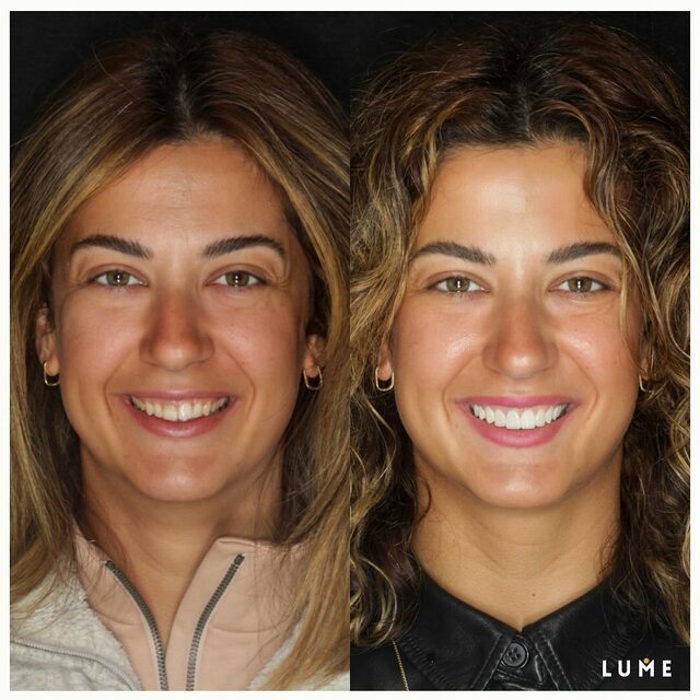 Orthodontists Wilmslow LUME DENTAL