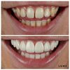 Private Dentists Wilmslow (2) - LUME DENTAL