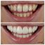 Private Dentists Wilmslow (2) - LUME DENTAL