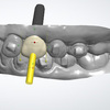 32955208-1a73-446e-8022-396... - Cusp Dental Design