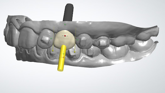 32955208-1a73-446e-8022-396e1cca51f1 Cusp Dental Design