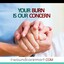 your burn is our concern - woundcaremart