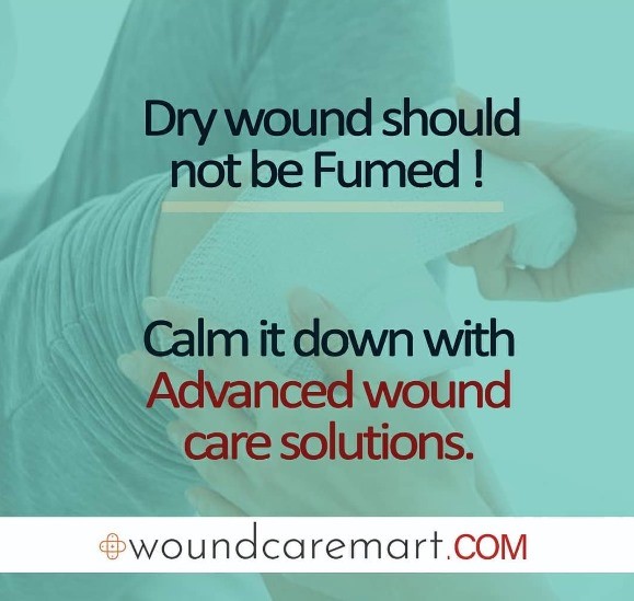 woundmart feb 4 woundcaremart