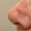 Skincare Facials Fargo - Skincare Facials Fargo