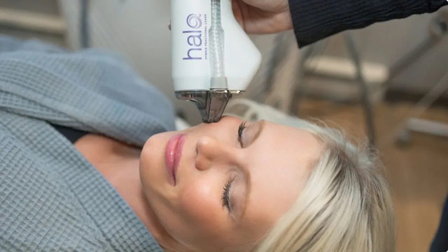 Halo Laser treatment (1) Skincare Facials Fargo
