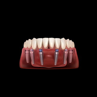 Clínica Dental Tapias | Dentista en Alcorcón Picture Box