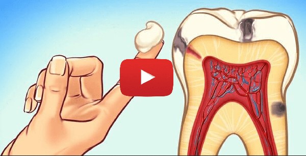weyt Cure Bad Breath & Gum Disease Fast – Proven Solutions!
