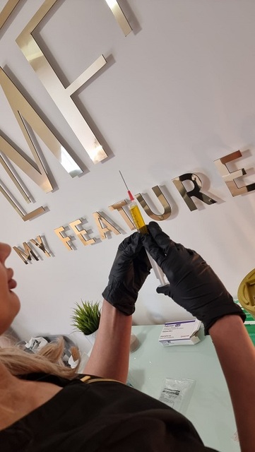 Fat dissolving MY FEATURES - Aesthetics & I/V Infusion Clinic