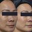 c2 - The Melasma Clinic