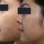 c3 - The Melasma Clinic