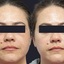 x1 - The Melasma Clinic