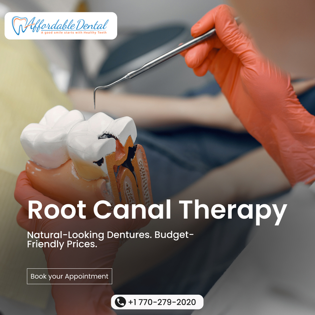 Expert Root Canal Therapy for Long-Lasting Dental  Aahaa Indian Taste