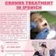 crowns treatment in ipswich - Picture Box