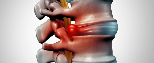 Spine Specialist in Mumbai Picture Box