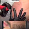 alopeciaareata | lionscalp - Picture Box