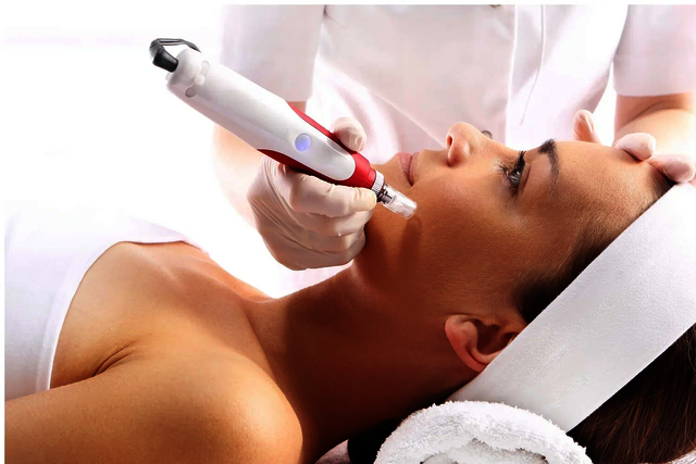 gsfg-e1738515979234 I Care Skin Advance Laser Centre