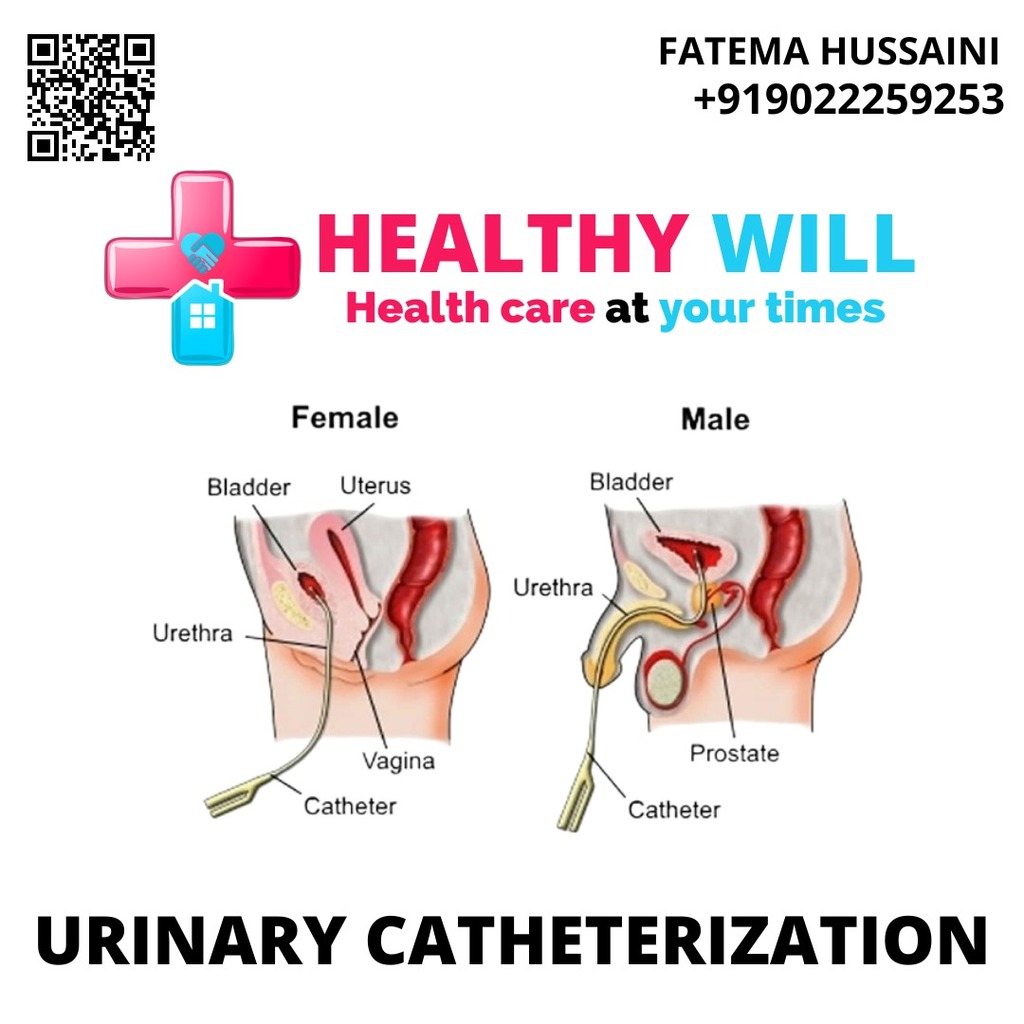 Urinary Catherization Healthy Will
