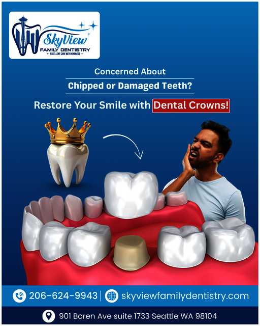 chipped tooth repair seattle Picture Box