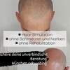 Trichopigmentation München - Picture Box