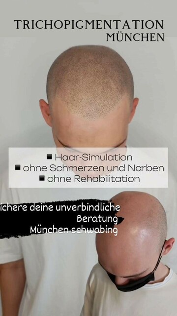 Trichopigmentation München Picture Box