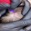 Narbe kaschieren | lionscalp - Picture Box