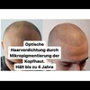 Hairline München | lionscalp - Picture Box