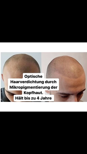 Hairline München | lionscalp Picture Box