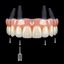 Permanent Dental Implants i... - simplyteethmountprospect
