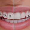 Orthodontist Near Me - Kids Orthodontist & Childre...