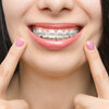 Kids Orthodontist & Children's Braces of Queens