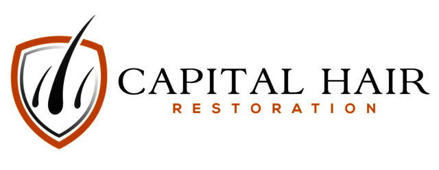 Capital Hair Restoration - Hair Transplant Capital Hair Restoration - Hair Transplant
