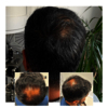 06608eb8-d6f3-4e62-abd8-dc9... - Capital Hair Restoration - ...