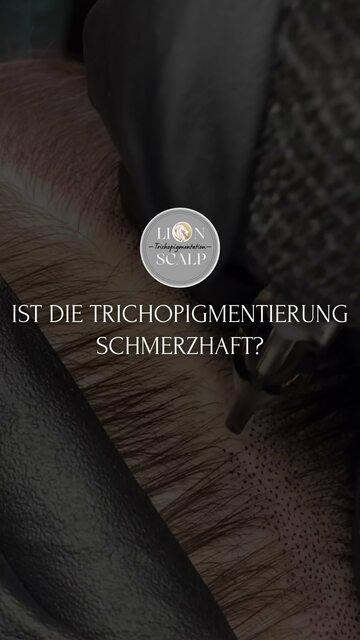SMP Pigmentation München | lionscalp Picture Box