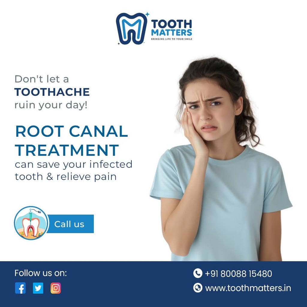 root canal treatment Picture Box