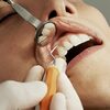 photo-1606811971618-4486d14... - Oral Surgery West Covina