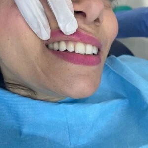 c1 Divina Dental Center | Dr. Nada Lahbichi - Spécialiste en dentisterie esthétique à Tanger | Médecin dentiste à Tanger