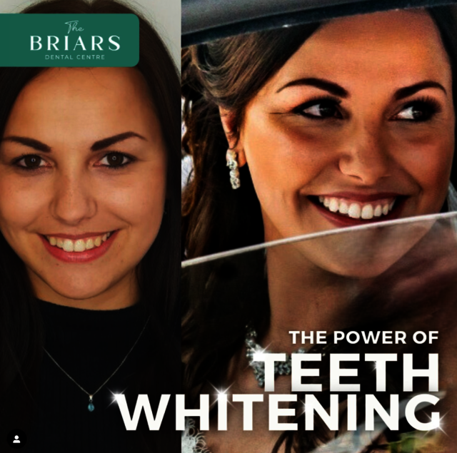 Best dentist in Newbury The Briars Dental Centre